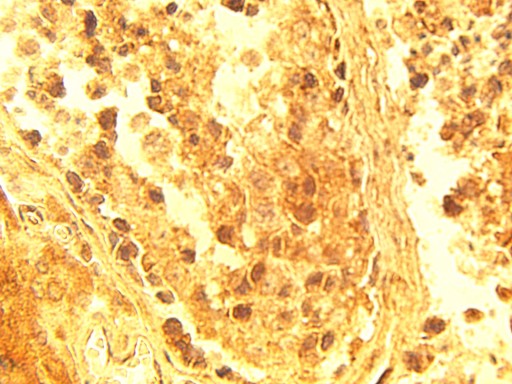 Immunohistochemical staining of normal human testis tissue using ELOV4 antibody (Cat. No. X2381P) at 15 µg/ml.